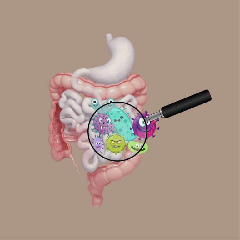 Tout savoir sur le SIBO (Small Intestinal Bacterial Overgrowth)